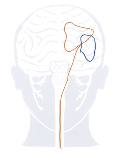 25- muscle + s:t resoln to muscle