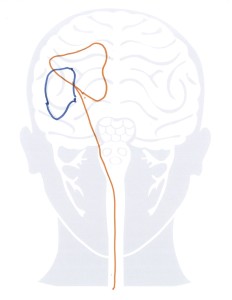 edit overlapped records generate tension pattern to muscle copy